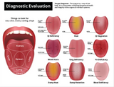 Questions & Answers - Acupuncture Brochure (Pre-order - 200 + 150 Free Brochures + Laminated Charts)